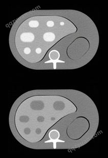 德国QRM-半拟人化肝脏模体(检查肝脏区域低对比度细节)